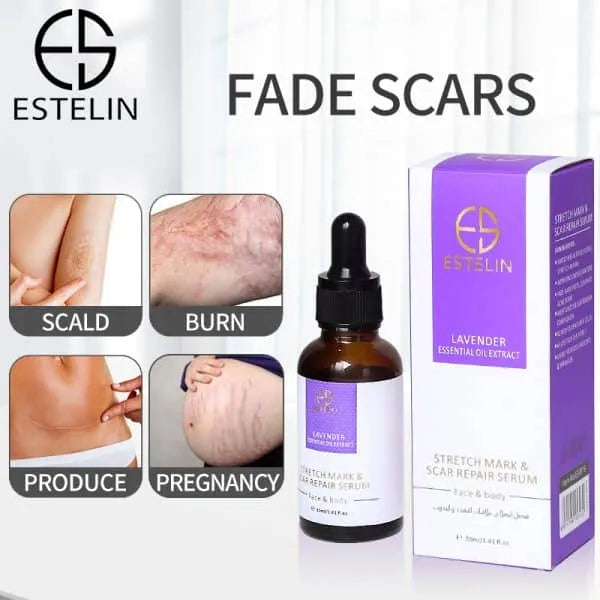 Estelin Stretch Mark Serum