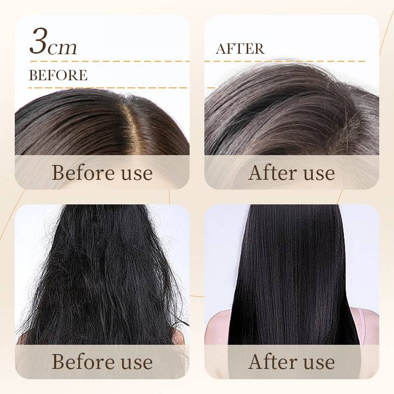 Bioaqua Rice Raw Pulp Removal Dandruff Shampoo - 500ml